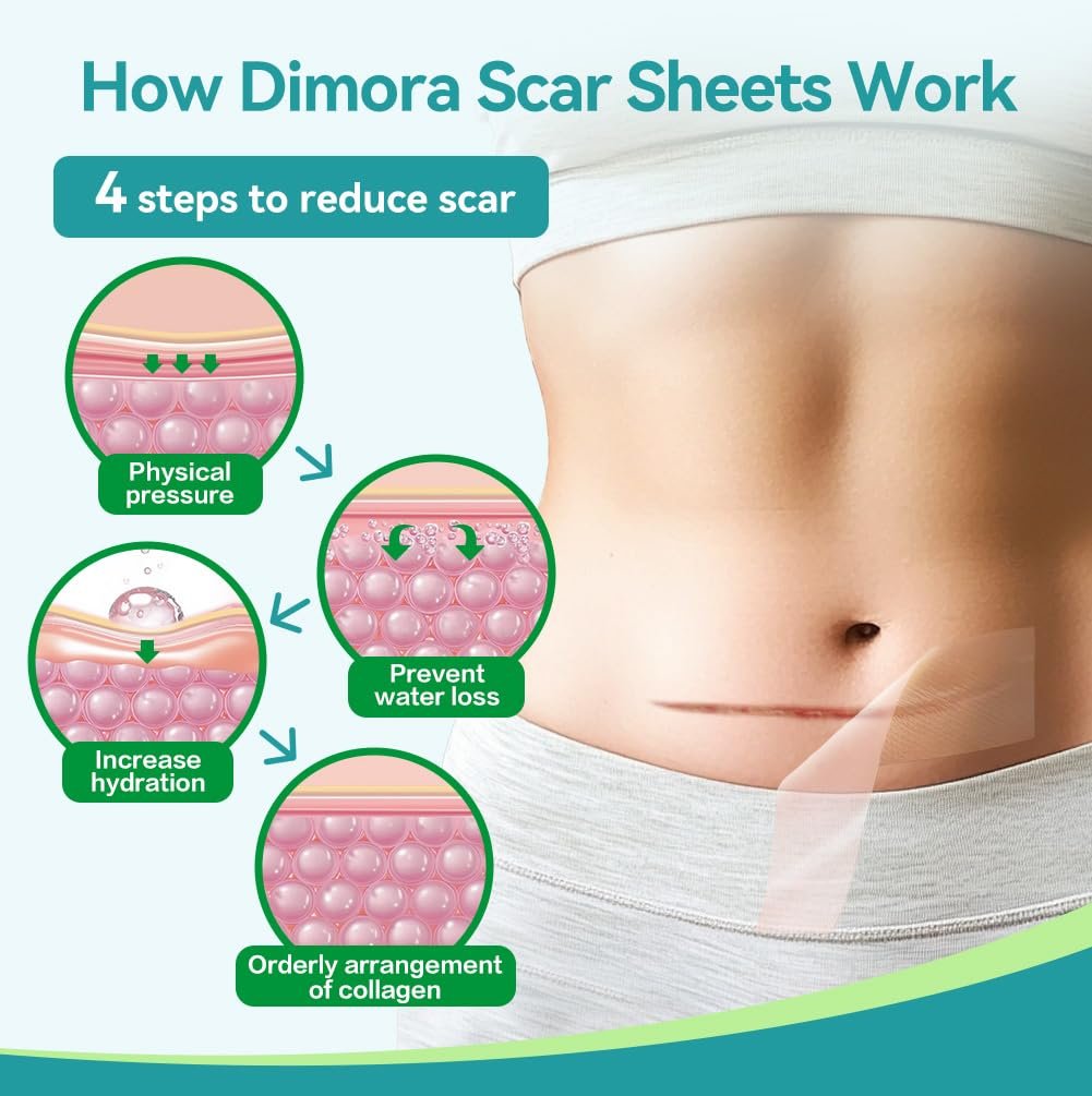 Dimora Medical Grade Silicone Scar Sheets - Ultra Soft Silicone Scar Tape (1.6”x60" Roll), Hypoallergenic Scar Removal Treatment for Surgical Scars, C Section, Tummy Tuck, Keloid Treatment - görsel 13