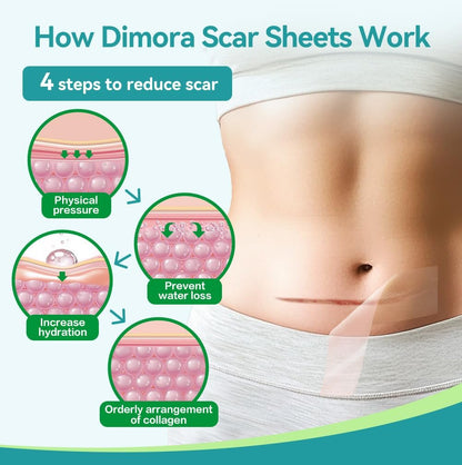 Dimora Medical Grade Silicone Scar Sheets - Ultra Soft Silicone Scar Tape (1.6”x60" Roll), Hypoallergenic Scar Removal Treatment for Surgical Scars, C Section, Tummy Tuck, Keloid Treatment