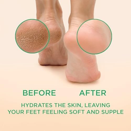 Lee Beauty 8oz Professional Gel Callus Remover for Feet - Peppermint Fast-Acting Formula, Extra Strength for Cracked Heels & Dead Skin (Pack of 1) - görsel 4