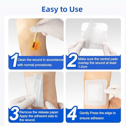 Niceful 50 Pcs Adhesive Gauze Island – Material: Polyurethane (PU) backing, non-woven pad – Image 2