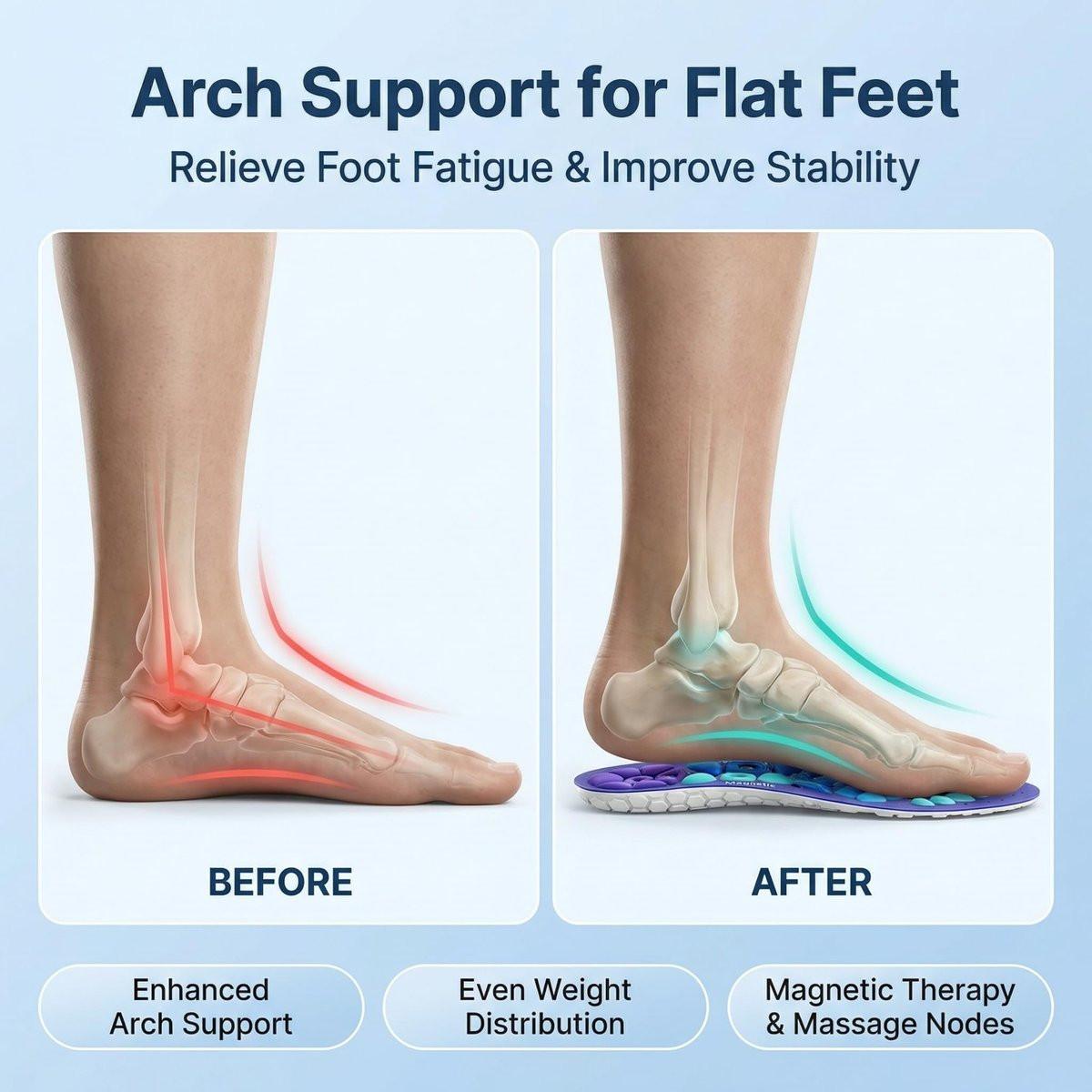 Acupressure Insoles for Men and Women: Magnetic Massage Insoles with Acupoint Therapy, Shock Absorption, Non-Slip, Feet Comfort Support (Blue, L(Men 9.5-12/Women 10.5-13)) - görsel 8