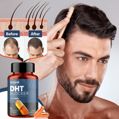 DHT Blocker for Men with Saw Palmetto & Biotin, Hair Growth Formula in Liquid-Filled Capsules, Hair Loss Supplements, Hair Regrowth Vitamins, Proprietary Herbal Blends - 90 Capsules (1 Bottle)