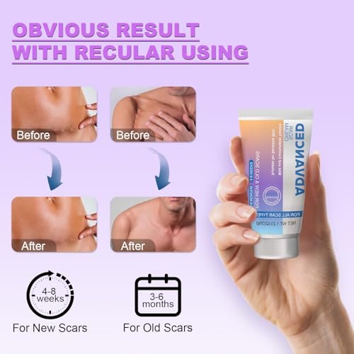 Silicone Scar Cream Scar Gel - Advanced Scar Treatment Keloid Bump Removal for Surgical Scars, C-Section, Injury, Stretch Marks, Acne, Burns, Keloids, Old & New Scars, 1.23Oz (35g) - görsel 10