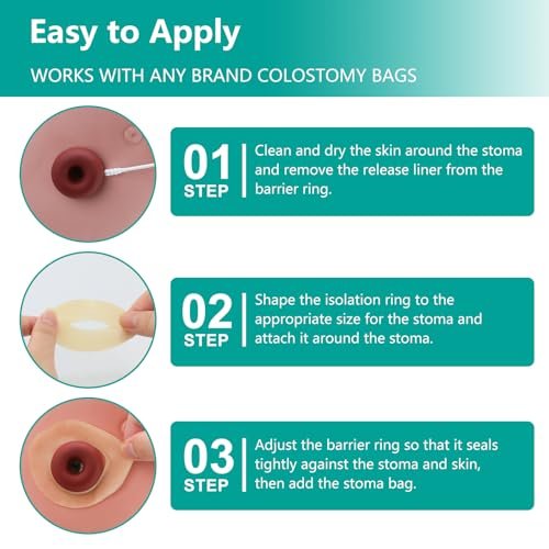 Ostomy Barrier Rings - Outer Diameter 2" (50mm) 2mm Thickness, Moldable Ostomy Rings, Hydrocolloid Skin Extender Rings for Colostomy Bags, 10 Count - görsel 8