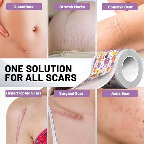 SLGCBL Silicone Scar Tape for Surgical Scars, Silicone Scar Sheets, C Section, Tummy Tuck (1.6”x 60”-1.5M) Reusable Scar Removal Strips for Face, Body, Burns & Keloid Scars - görsel 12