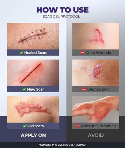 Silicone Scar Cream with 6.7% Active Ingredients, Scar Gel Visible in 2 Weeks, Moisturizing Scar Removal Clinically Shown for Surgical, C-Section, Keloid, Acne & Burn Scars, Stretch Mark Cream (55ML) - görsel 14