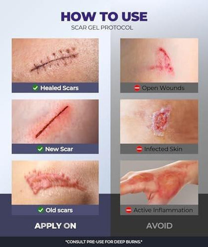Silicone Scar Cream with 6.7% Active Ingredients, Scar Gel Visible in 2 Weeks, Moisturizing Scar Removal Clinically Shown for Surgical, C-Section, Keloid, Acne & Burn Scars, Stretch Mark Cream (55ML)