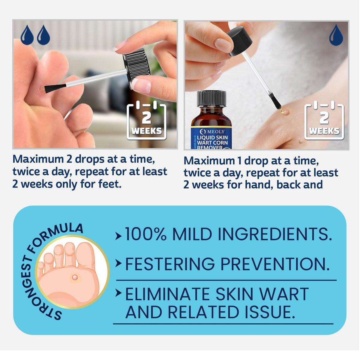 MEOLY Fast-Acting Wart Remover: 40% – Fast-Acting: The formula works quickly to dissolve wart tissue, reducing – Image 13