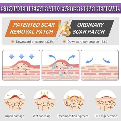 Silicone Scar Sheets, Medical Grade Silicone Scar Tape for Surgical, Hypertrophic, Keloid, C-Section, Burn, Old & New Scars, Reusable Professional Scars Removal Sheets (1.6"X 157" Roll-4M)
