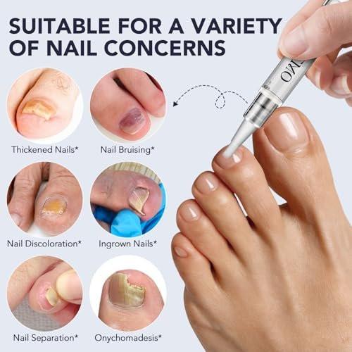 Toenail Fungus Pen - Toenail Fungus Treatment Extra Strength - 25% Undecylenic Acid with Tea Tree, Jojoba - Fungal Nail Repair Kit for Damaged, Discolored, Ingrown Nails 5 Pack - görsel 17