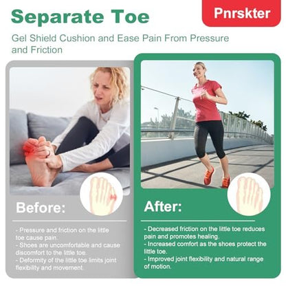 20pcs Pinky Toe Protector Women, Gel Toe Caps, Open Toe Sleeves, Breathable Toe Cushions for Blisters, Corns, Hammer Toes, Toenails Loss (Infused with Aloe Vera Extract)