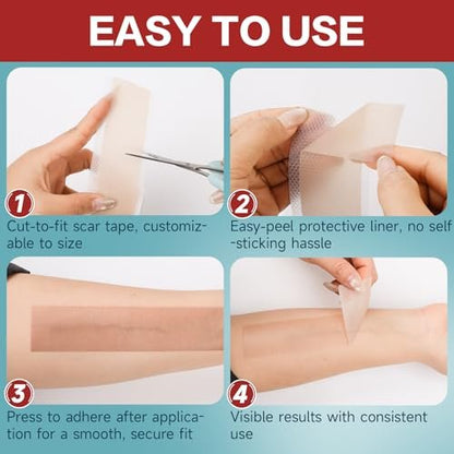 Silicone Scar Tape 1.6”x60” Roll – Reusable Silicone Scar Sheets for Surgical, C-Section, Tummy Tuck, Keloid Scars – Easy to Cut
