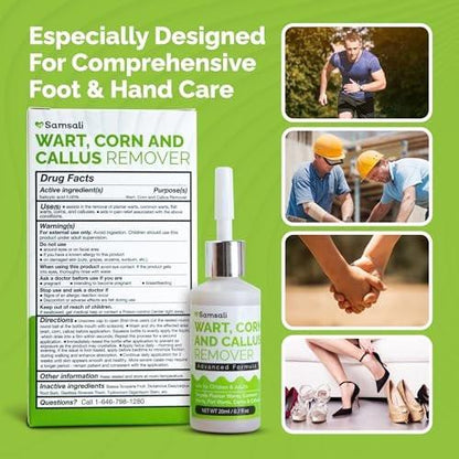 Samsali Liquid Plantar Wart Remover: 20ml Salicylic Acid Liquid for The Removal of Plantar Flat Warts Corns Calluses on Feet Toes and Hands - Safe for Teens Adults Seniors Men and Women