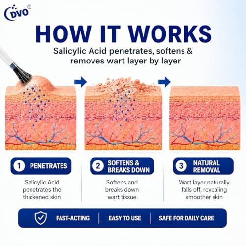 DVO 20% Salicylic Acid Wart Remover Liquid, Maximum Strength Fast-Acting, Painless Wart Removal, Common & Flat Warts, Foot Corn, for Men & Women, 30ML - görsel 6
