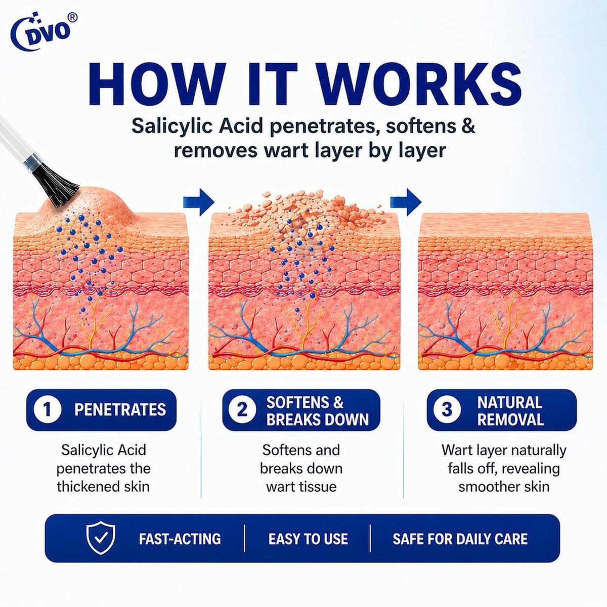 DVO 20% Salicylic Acid Wart Remover Liquid, Maximum Strength Fast-Acting, Painless Wart Removal, Common & Flat Warts, Foot Corn, for Men & Women, 30ML - görsel 5