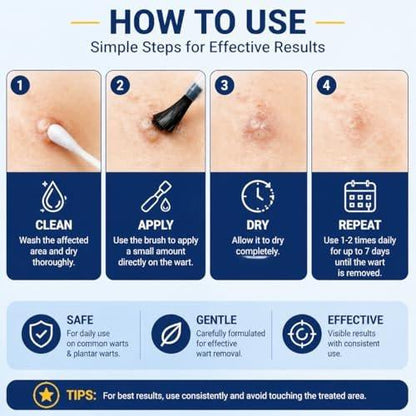 DVO 20% Salicylic Acid Wart Remover Liquid, Maximum Strength Fast-Acting, Painless Wart Removal, Common & Flat Warts, Foot Corn, for Men & Women, 30ML