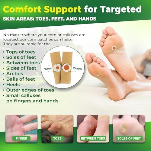 Ulensy Corn Remover Pads for Feet Toes: 30-Pack Salicylic Acid Extra Strength Treatment - Fast Effective Medicated Bandages for Kids Adults Seniors Teens Athletes Runners Hikers Workers Men Women - görsel 4