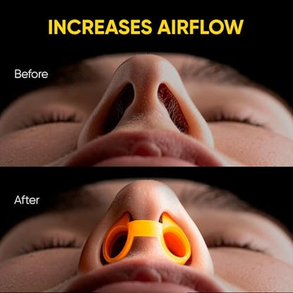 Nasal Dilators - Silicone Nose Clips for Better Sleep – Nasal Dilators for Sleeping and Breathing - Comfortable Snore Stopper – Less Snoring Nose Vents to Reduce Snoring - Yellow