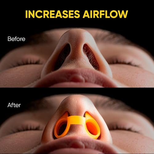 Nasal Dilators - Silicone Nose Clips for Better Sleep – Nasal Dilators for Sleeping and Breathing - Comfortable Snore Stopper – Less Snoring Nose Vents to Reduce Snoring - Yellow - görsel 8