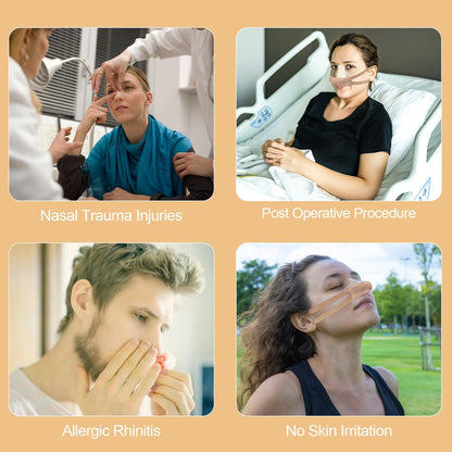 Elasticated Nose Bandage, Nasal Dressing Holder, Individually Wrapped for Post-Surgery Rhinoplasty & Septoplasty Recovery, External Breathable Nose Cover with High Absorption (10 Pcs, Beige)